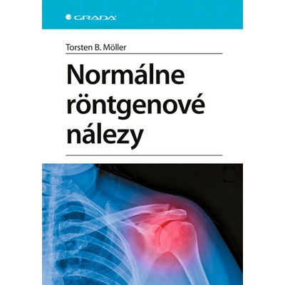 Normálne röntgenové nálezy - B Moller. Torsten