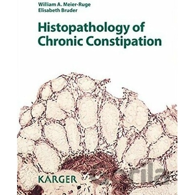 Histopathology of Chronic Constipation - Elisabeth Bruder a kol.