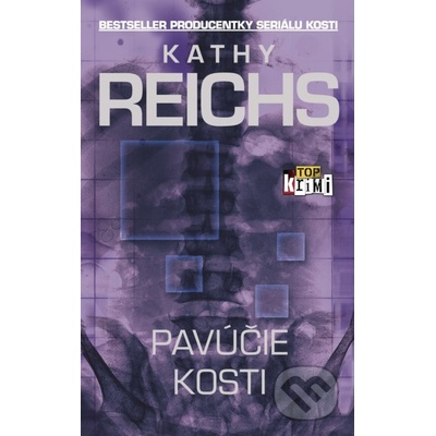 Pavúčie kosti - Kathy Reichs