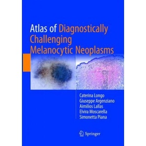 Atlas of Diagnostically Challenging Melanocytic Neoplasms (2019)