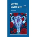 Myómy maternice - Mikuláš Redecha