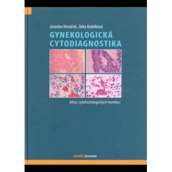 Gynekologická cytodiagnostika - Jaroslav Horáček, Jitka Kobilková