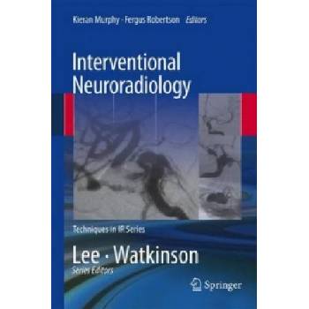 Interventional Neuroradiology | Fergus Robertson