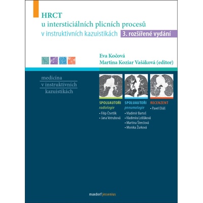 HRCT u intersticiálních plicních procesů v instruktivních kazuistikách - Eva Kočová, Martina Vašáková