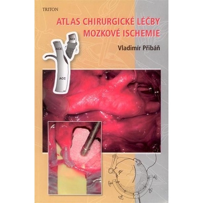 Atlas chirurgické léčby mozkové ischemie