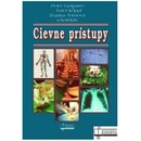 Cievne prístupy