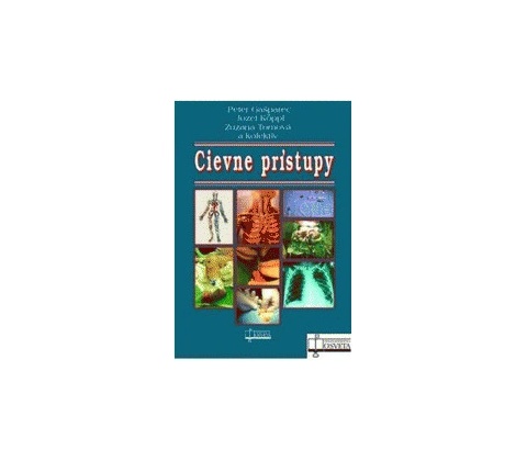 Cievne prístupy