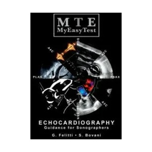 Echocardiography - MyEasyTest | GIUSEPPE FELITTI (ISBN: 9780244317614)