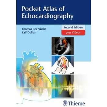 Image 1 of Pocket Atlas of Echocardiography | Thomas Böhmeke, Ralf Doliva