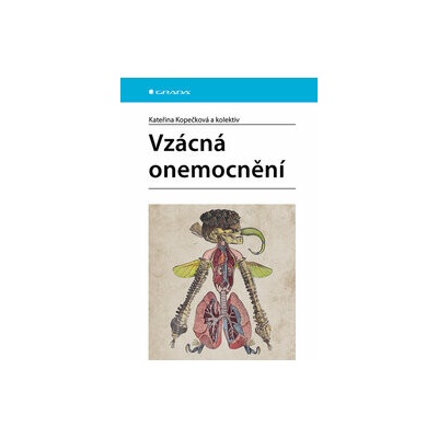 Vzácná onemocnění