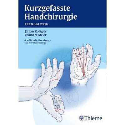 Kurzgefasste Handchirurgie