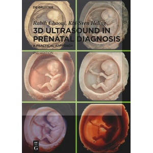 3D Ultrasound in Prenatal Diagnosis (ISBN: 9783111249094)