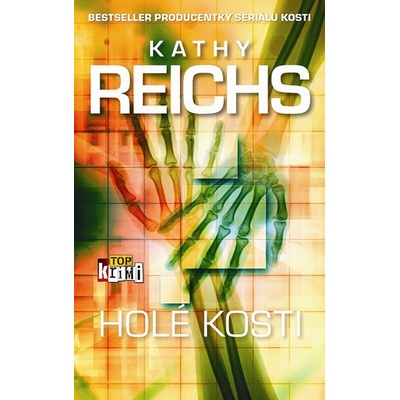 Holé kosti