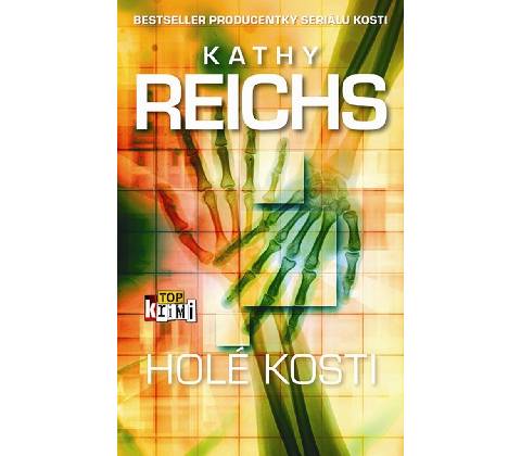 Holé kosti