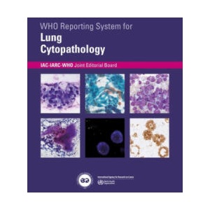 Who Reporting System for Lung Cytopathology | IAC-IARC-WHO Joint Editorial Board, IAC-IARC-WHO Joint (ISBN: 9789283245162)