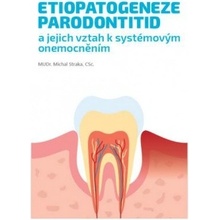 Etiopatogeneze parodontitid a jejich vztah k systémovým onemocněním - Michal Straka