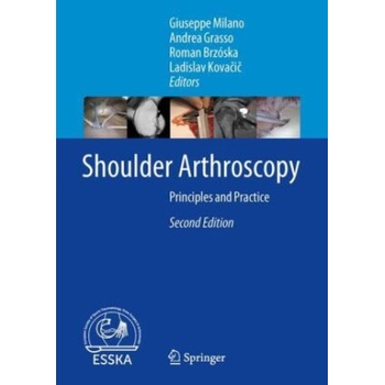 Shoulder Arthroscopy