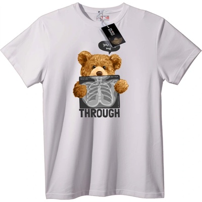 NOONEBRAND Тениска Рентгенов Мечок - 7XL, Black