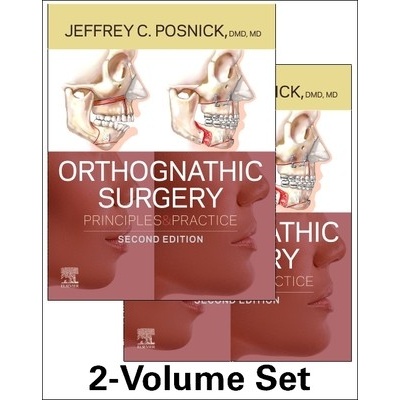 Orthognathic Surgery - 2 Volume Set Posnick Jeffrey C.