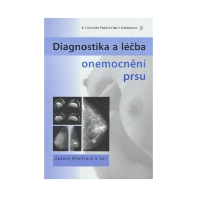 Diagnostika a léčba onemocnění prsu