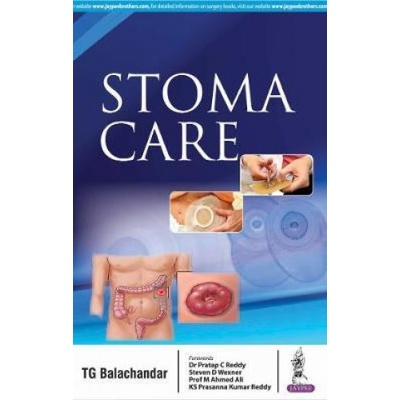 Stoma Care TG Balachandar
