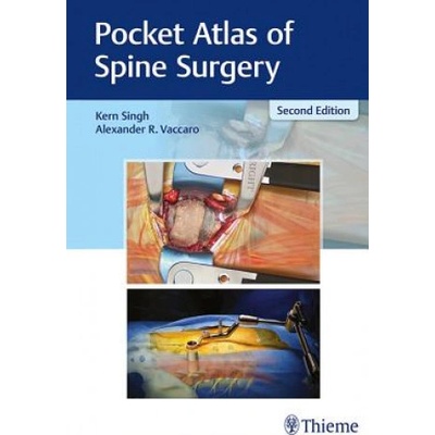 Pocket Atlas of Spine Surgery