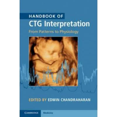 Handbook of CTG Interpretation | Edwin Chandraharan