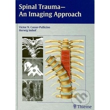 Spinal Trauma - Thieme