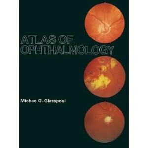 Atlas of Ophthalmology | M. G. Glasspool (ISBN: 9789401172615)