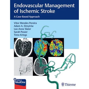 Endovascular Management of Ischemic Stroke | Lee-Ann Slater, Sarah Power, Timo Krings (ISBN: 9781626232754)