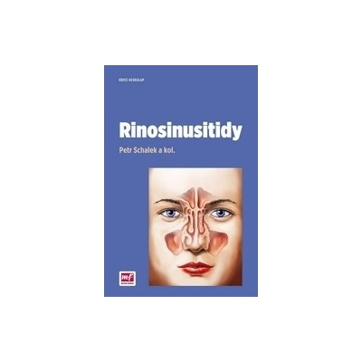 Rinosinusitidy