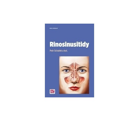 Rinosinusitidy