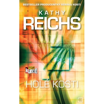 Holé kosti