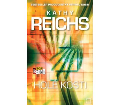 Holé kosti