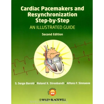 Cardiac Pacemakers and Resynchronization Step by Step - An Illustrated Guide 2e