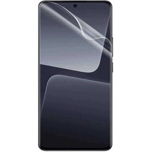 Ochranná fólie SES Xiaomi 15 5G, 3ks