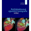 Knihy Multidetektorová výpočetní tomografie srdce