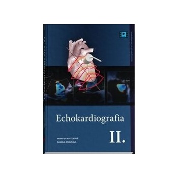 Echokardiografia II.