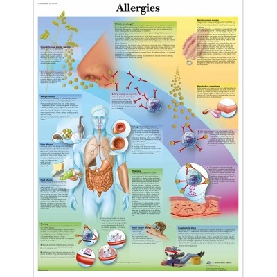 Schéma - alergia - AJ - 50x67 cm - DOPREDAJ Papier bez lišty