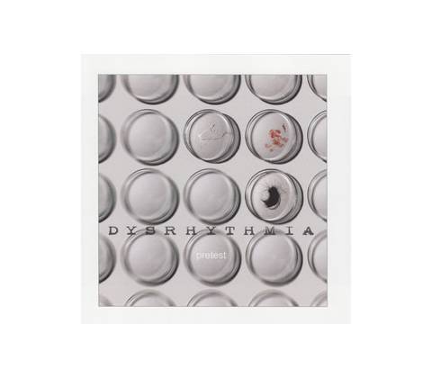 DYSRHYTHMIA: PRETEST CD