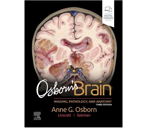 Osborn's Brain