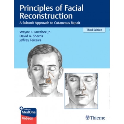 Principles of Facial Reconstruction