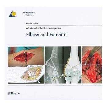 AO Manual of Fracture Management - Elbow & Forearm | Jesse B. Jupiter