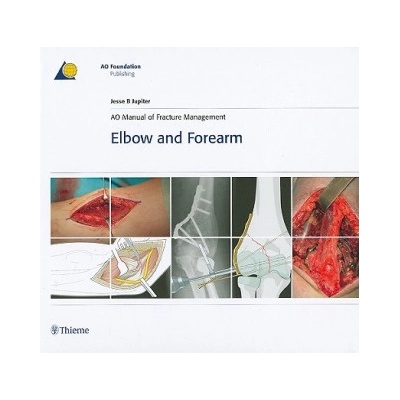 AO Manual of Fracture Management - Elbow & Forearm | Jesse B. Jupiter