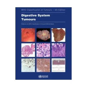 Digestive System Tumours: Who Classification of Tumours | Who Classification of Tumours Editorial (ISBN: 9789283244998)