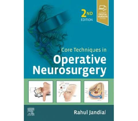 Core Techniques in Operative Neurosurgery