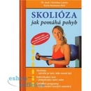Skolióza
