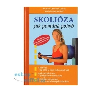 Skolióza