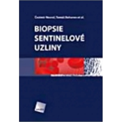 Biopsie sentinelové uzliny Čestmír Neoral