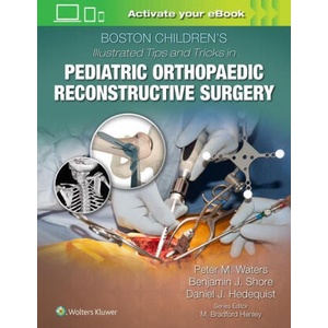 Boston Children's Illustrated Tips and Tricks in Pediatric Orthopaedic Reconstructive Surgery (2021)
